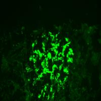 Deep Renal Biopsy Immunofluorescence Image Analysis